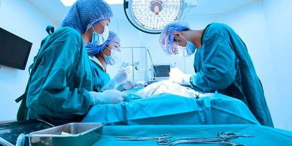operacija povečanja penisa